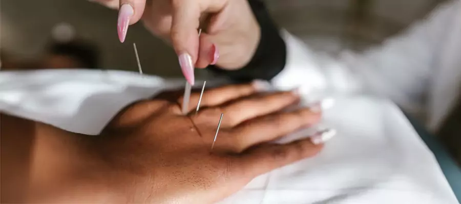 akupunktur-ignesi-6826e44ce2877