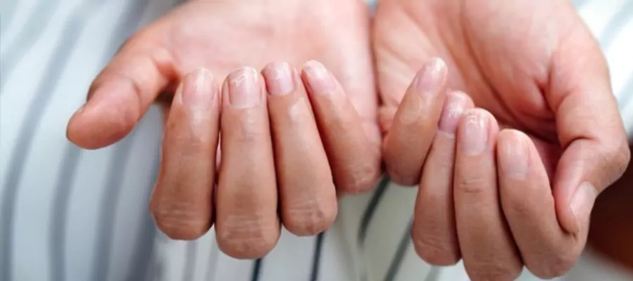 demir-eksikligi-6826e44b6349c