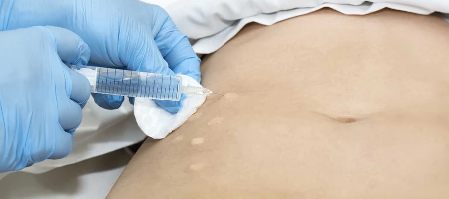 mezoterapi-ile-zayıflama